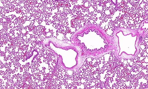 HE染色的原理和意义
